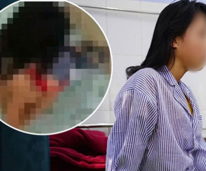 Nữ sinh bị lột đồ đánh hội đồng vẫn đang trong tình trạng hoảng loạn, thường xuyên ôm đầu la hét
