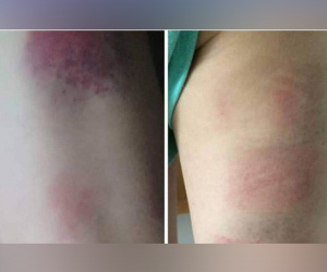 Cuộc điện thoại khiến phụ huynh bức xúc của cô chủ nhiệm bị tố đánh 22 học sinh