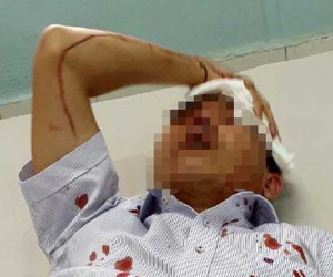Đậu ôtô trước chung cư, 2 người bị nhóm côn đồ đánh nhập viện