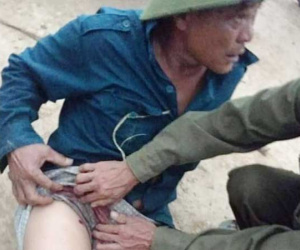 Tạm giữ hình sự kẻ đi xe hơi dùng súng bắn trưởng thôn