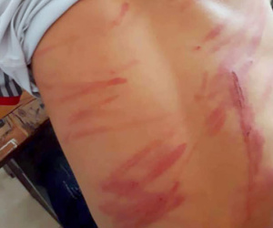Hà Tĩnh: Nghi bị bố ruột đánh bầm tím người, nam sinh lớp 8 đến trường hoảng sợ rồi ngất xỉu