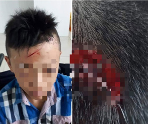 Vĩnh Long: Xác minh thông tin nam sinh lớp 7 bị bạn đánh chảy máu đầu, ngất xỉu 2 lần nhưng nhà trường không đưa đi cấp cứu