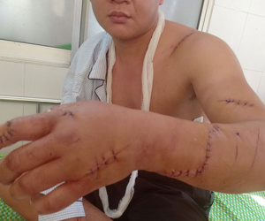 Bị chém trọng thương vì tranh cãi trong lúc đánh bài