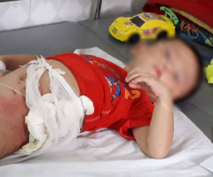 Hòa Bình: Cậu ruột ném cháu trai 4 tuổi vào đống lửa vì giành ăn quả dưa chuột