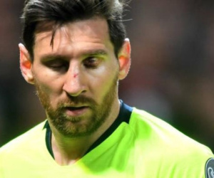 Messi tổn thương mắt nghiêm trọng, có thể nghỉ thi đấu 2 trận