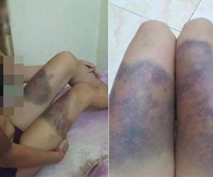 Nhóm người giam thai phụ 18 tuổi hơn nửa tháng, tra tấn làm chết thai nhi