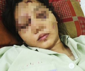 Cô gái mang bầu 6 tháng bị bắt cóc, tra tấn đến sảy thai bị sang chấn tâm lý, la hét, kích động trong bệnh viện