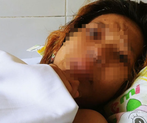 Dụ dỗ xin con nuôi không được, gã đàn ông dùng xăng đốt cháy người mẹ trẻ