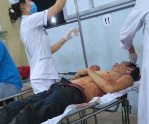 Bắt nghi phạm chém hàng xóm 17 nhát vì chê 'hát như nhạc đám ma'