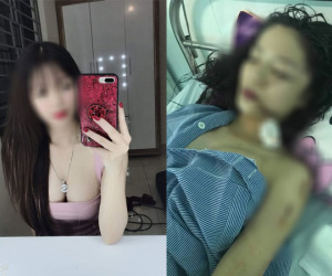 Chị ruột cô gái bị tấn công phải khâu 60 mũi: 'Mặt em tôi bị rạch như thế thì coi như hết đời người rồi'