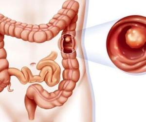 Loại đồ uống ưa thích gây ra 230 bệnh, 8 loại ung thư ở người Việt