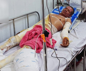 Chiết xăng xe để đi làm nuôi vợ con, người đàn ông bị bốc cháy, hóa thành 'ngọn đuốc sống'