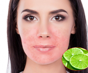 4 sản phẩm tự nhiên thường được khuyên để dưỡng da mặt nhưng thực ra lại gây hại không tưởng, chị em hãy nhớ kỹ