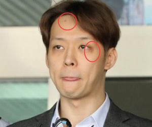 Yoochun dùng ma túy xong đập đầu vào tường, dấu vết còn y nguyên trên trán trong ngày bị còng tay?