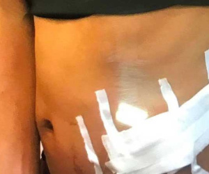 Tìm kiếm nạn nhân bán thận để điều tra đường dây buôn bán nội tạng xuyên quốc gia 'khủng'
