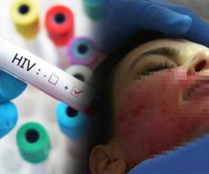 Sững người trước kết quả dương tính với HIV sau thẩm mỹ, đã có 1 trường hợp tại Việt Nam