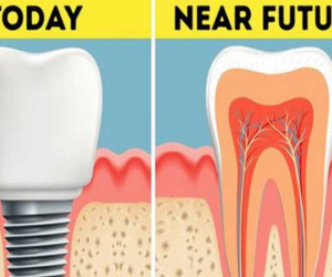 Không phải trồng răng giả nữa: Khoa học đã tìm ra cách giúp bạn mọc lại răng mới chỉ sau 2 tháng