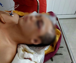 Truy lùng hung thủ chém người, cướp tài sản giữa ban ngày