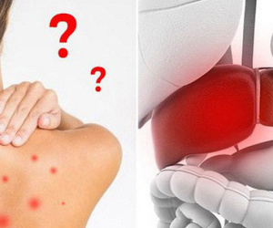 Khi bạn uống nước rồi những vẫn cảm thấy khát: Hãy cảnh giác với 5 căn bệnh nguy hiểm