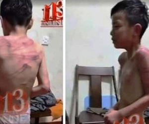 Thông tin bé trai bị bố dượng đánh đập ở Thanh Hóa là thất thiệt