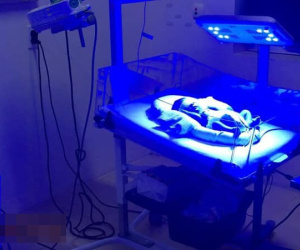 Bức ảnh đứa trẻ sơ sinh thoi thóp trong lồng ấp gây xót xa, nguyên nhân đằng sau mới là thứ khiến nhiều người phẫn nộ