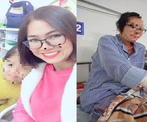 1 năm sau khi bị chồng cũ tạt axit, cô giáo Hà Nội xinh đẹp kể về 5 ngày chết lâm sàng, 21 lần ghép da