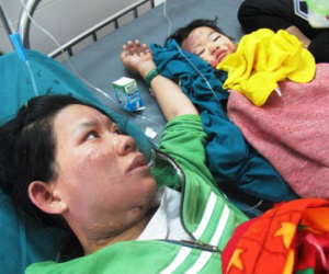 Bồng con nấu ăn, 2 mẹ con bị bỏng nặng