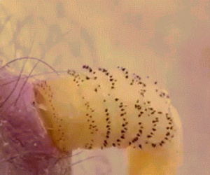 Nhà khoa học tự nuôi giòi trong cơ thể để nghiên cứu