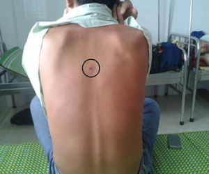 Trưởng công an xã bị tố bắn, đánh dân nhập viện