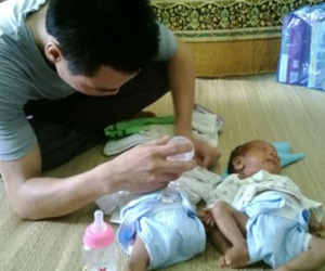 Người chồng trẻ loay hoay với vợ trầm cảm, con sinh đôi suy dinh dưỡng nặng