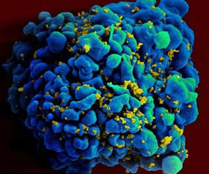 Tìm ra vắc xin phòng HIV?