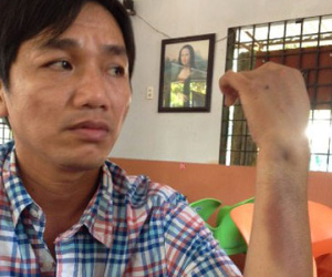 Con trai giám đốc công an tỉnh Cà Mau: "Tôi bị đánh hội đồng"