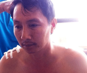 Ảnh bìa bài viết 286437