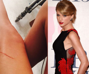 Taylor Swift bị mèo cưng cào rách "đôi chân 850 tỷ đồng"