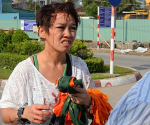 Bị rào chắn công trình đè trúng, người đi đường nhập viện