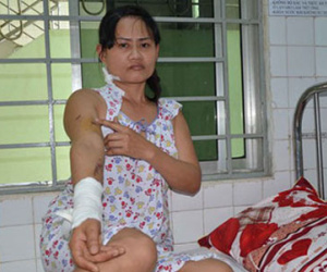 Pháo hoa rơi trúng đầu, 3 người nhập viện