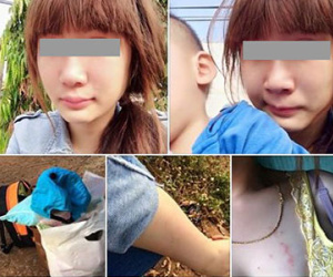 Cô gái lên mạng tố bị nhà chồng đánh hội đồng