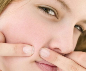 Có thật lấy chồng sẽ hết mụn?