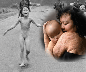 "Em bé napalm" nhớ lại ngày dội bom kinh hoàng