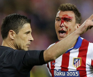 Mandzukic đổ máu vì Ramos, đo ván vì Carvajal