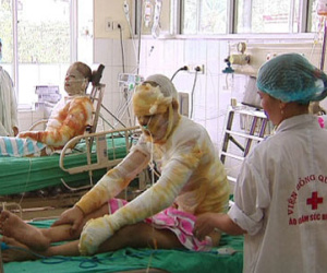 5 trong 6 nạn nhân vụ bỏng ở Quảng Ninh vẫn nguy kịch
