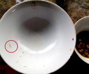 Hốt hoảng thấy "đỉa" bò lúc nhúc trong cua