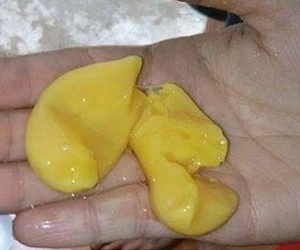 Trứng vịt có lòng trắng bám “như đỉa” gây hoang mang
