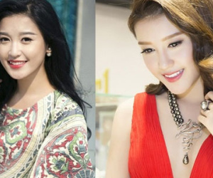 Á hậu Huyền My giãi bày lý do nhổ răng khểnh, thay đổi diện mạo