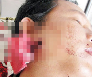 Kháng nghị vụ thanh niên trúng đạn từ súng trung tá công an