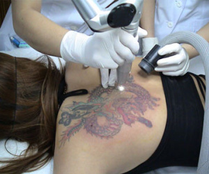 Thiếu nữ 16 tuổi đi cướp để xóa hình xăm