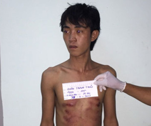 Say xỉn dùng kéo đâm chết bạn nhậu