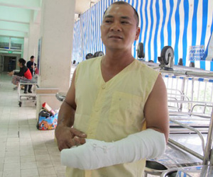 Tài xế xe tải chém tài xế xe khách gần lìa tay vì "bấm còi xin vượt"