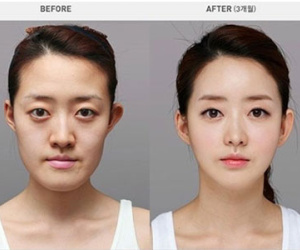 Chùm ảnh về PTTM khiến bạn phải thốt lên: Không có gì là không thể!