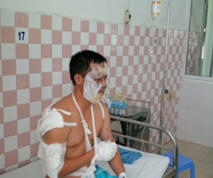 Cháy nổ kho hóa chất, 17 chiến sĩ PCCC bị thương
